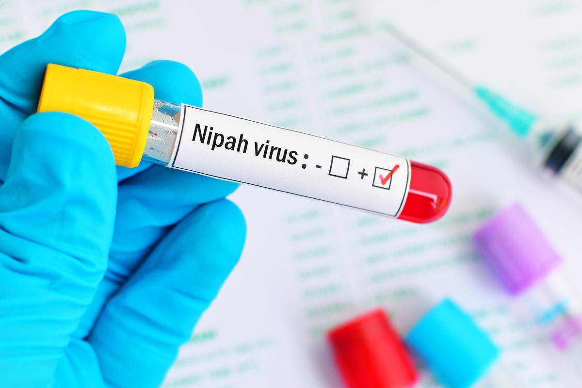 Did You Know About Kerala Nipah Virus Outbreak?
